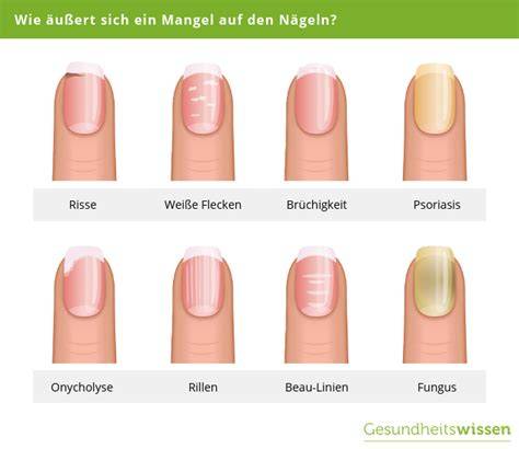 Problem-Lösung-Schema: Nicht aufgehen, zusammenfallen, wölben - Ursachen & Tipps