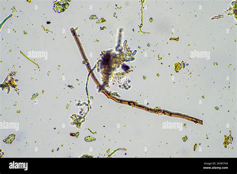 Psilocybinhaltige Pilze unter dem Mikroskop