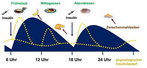 Schema: Insulinausschüttung nach Zuckerkonsum