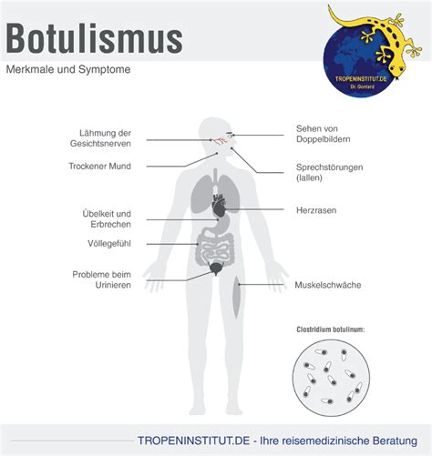Schema: Symptome des Säuglingsbotulismus