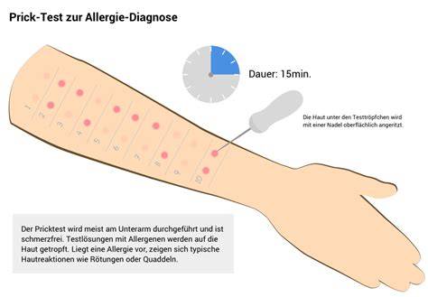 Schema Allergietests: Hauttest, Bluttest und IgE-Analyse