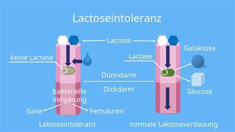 Schema Laktoseintoleranz