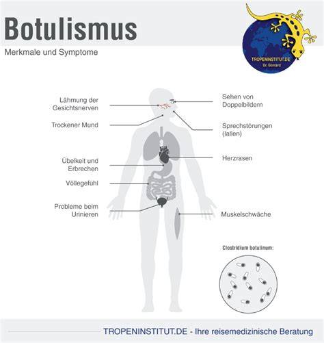 Schema der Botulismus-Symptome und Intensivbehandlung