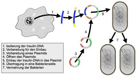 Schema zur Insulinproduktion bei unterschiedlichen Diabetesformen