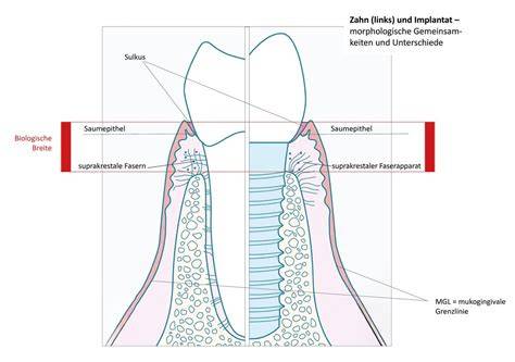 Schematische Darstellung: Was Süßes nach Zahn-OP - geeignete vs. ungeeignete Konsistenzen