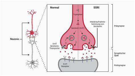Schematische Darstellung: Wirkweise von Pektin in Marmelade