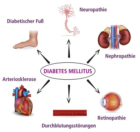 Spätfolgen von Diabetes mellitus: Organe, Nervenschäden, Blutgefäße
