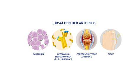 Symptome und Ursachen von Arthritis
