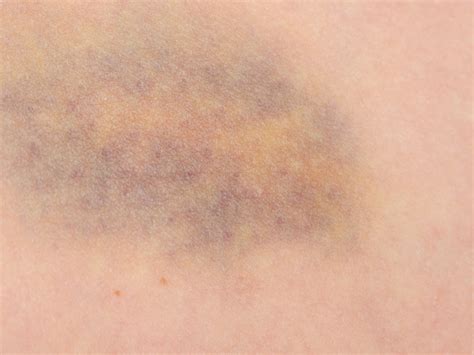 Thema: Manipulierte blau verfärbte Vulva