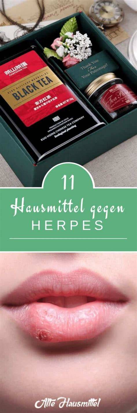 Vergleich: Hausmittel gegen Herpes