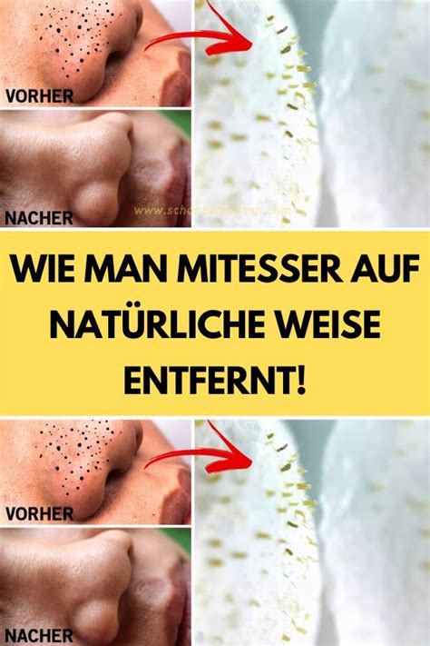 Vergleich: Natürliche Hausmittel gegen Mitesser und Poren
