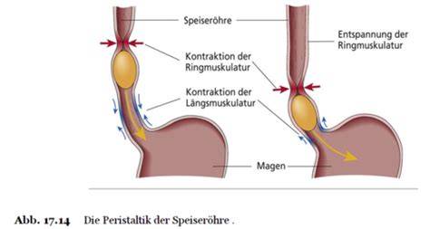 Verlauf der Schädigung durch Knopfbatterie in der Speiseröhre