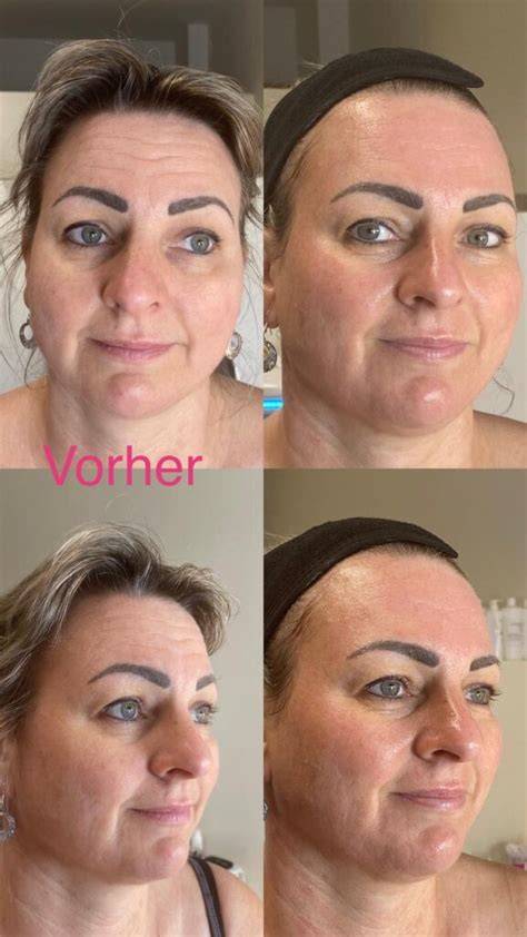 Vorher-Nachher: Wirkung von Honig-Shampoo