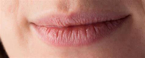 Winterpflege für Lippen: Ursachen von Austrocknung