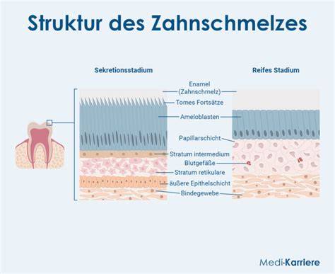 Xylitol-Wirkung auf Bakterien und Zahnschmelz (Schema)