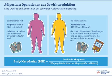 Zukunft der Adipositas-Therapie: Wirkstoff-Entwicklung und multimodale Behandlung