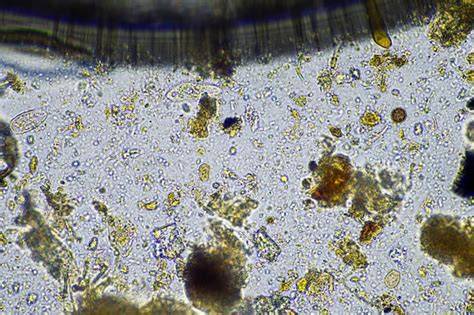 mikroskopische Aufnahme bräunlicher Untergrund im Honig