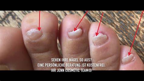problemlösung: brüchige streifen, temperatur und folie-trick