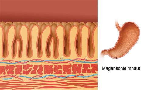 schematische Darstellung der Magenschleimhaut und Gastritis